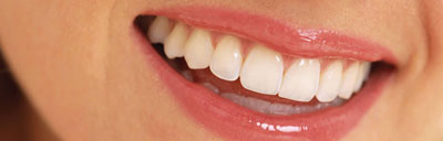 Estética Dental